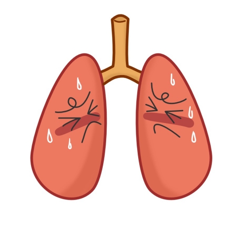 不健康な肺のイラスト